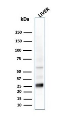 GSTM2 Antibody (CPTC-GSTMu2-2) - Azide and BSA Free, Novus Biologicals 100 &mu;g | Buy Online | Novus Biologicals | Fisher Scientific
